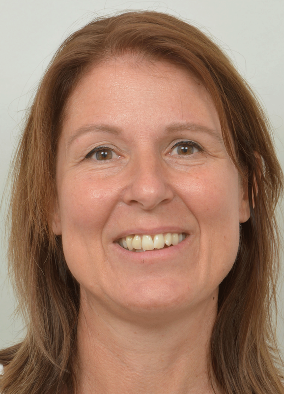 Simone Bunes, Dr. med., FMH Psychiatrie und Psychotherapie