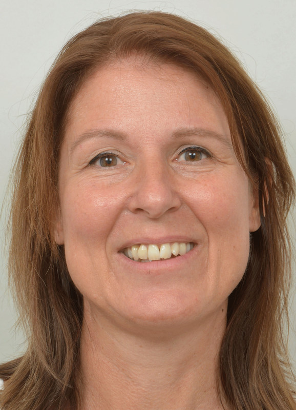 Simone Bunes, Dr.med., FMH Psychiatrie und Psychotherapie